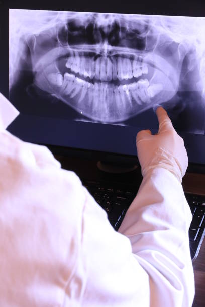Best Broken or Cracked Tooth Emergency Dentist in Hickory Hls, IL